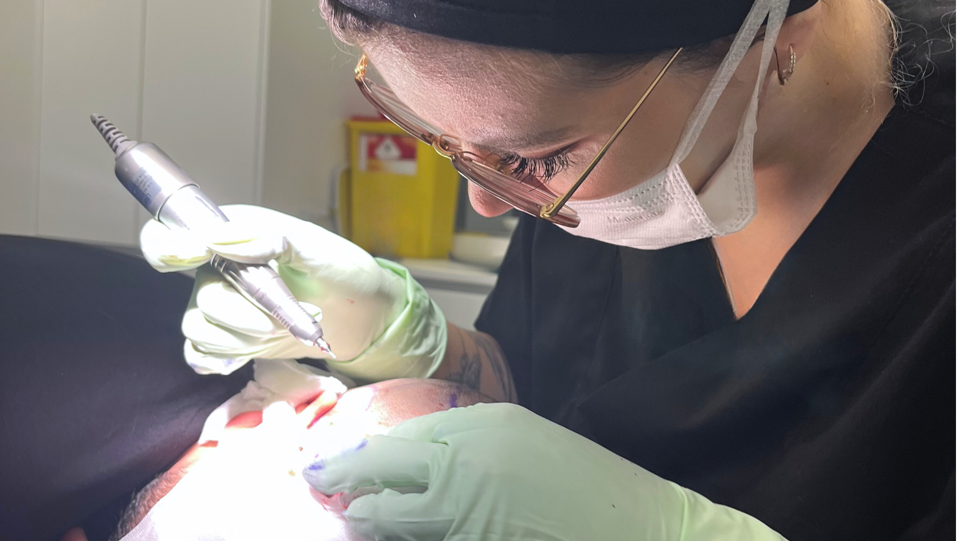 FUE vs. DHI: Welche Haartransplantations-Methode ist die richtige für Sie?